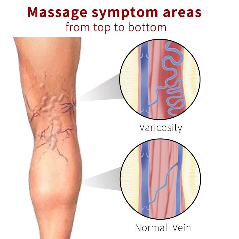 KanyeHB Varicose Veins Plaster Patch (6pcs/Bag)
