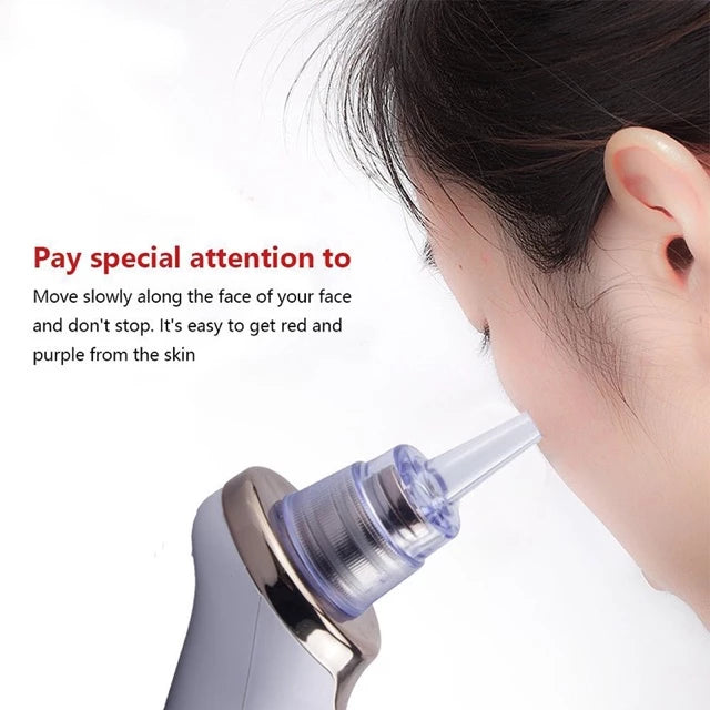 Beatiful Skin Care Expert Acne Blackhead Suction Pore Cleaner JB-8620