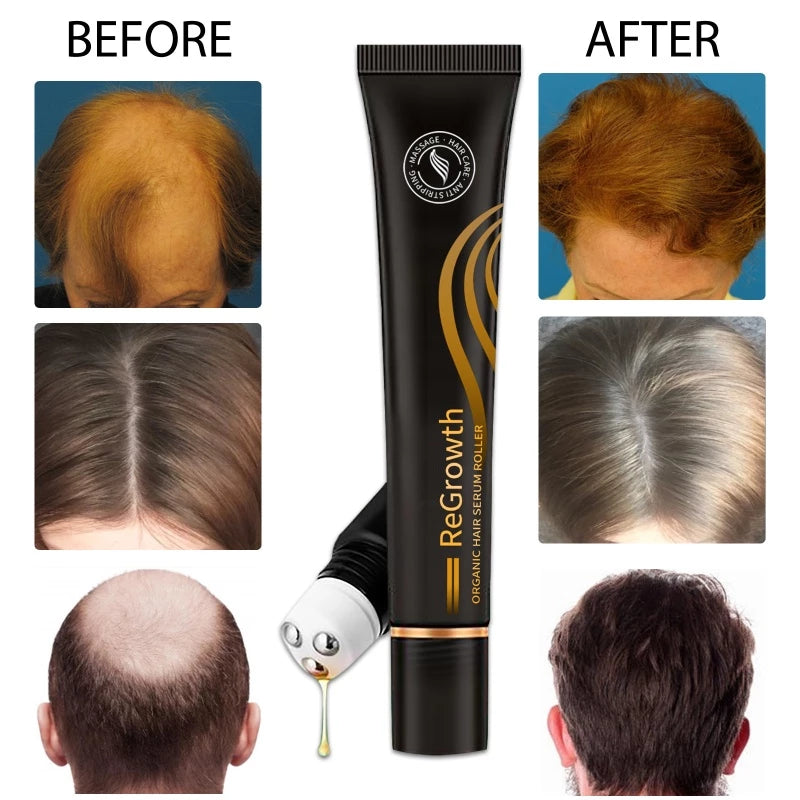 ReGrowth Organic Hair Serum Roller 20ml