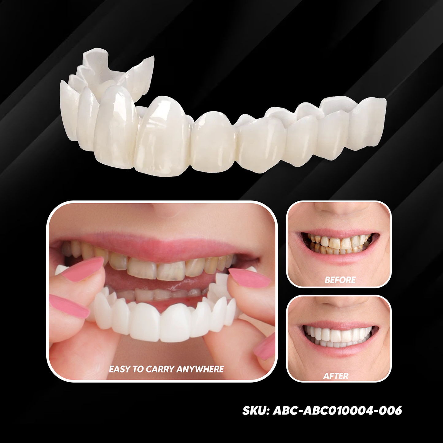 Snap On Smile