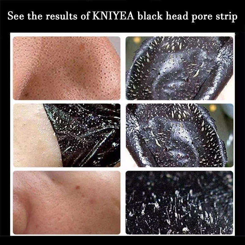 Black Head Pore Strip (PILATEN)