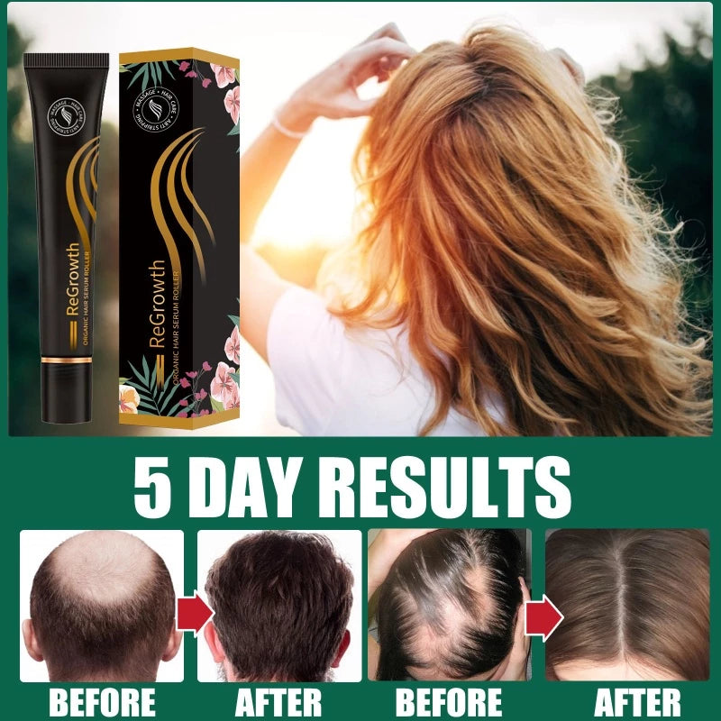 ReGrowth Organic Hair Serum Roller 20ml