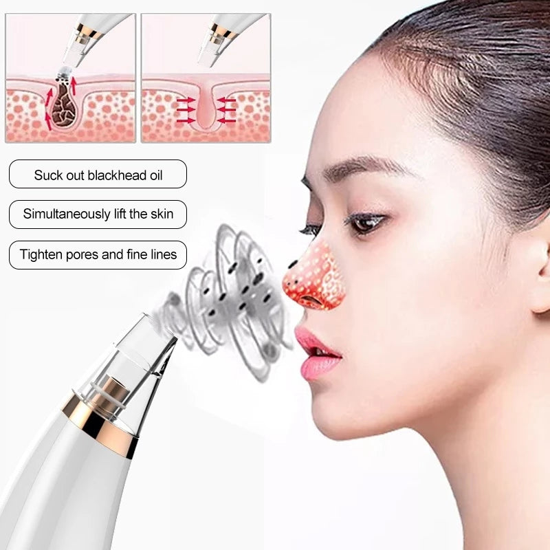 [A1-883] Blackhead Detector Vacuum Sunction Device