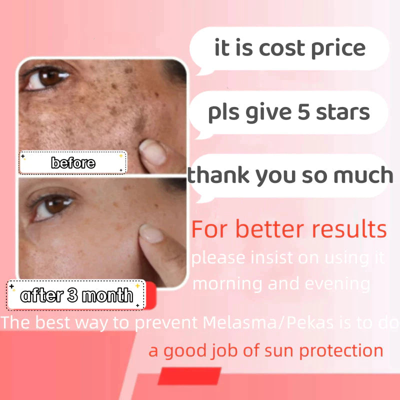 Houmai Skin Whitening and Freckle Removing Cream 20g