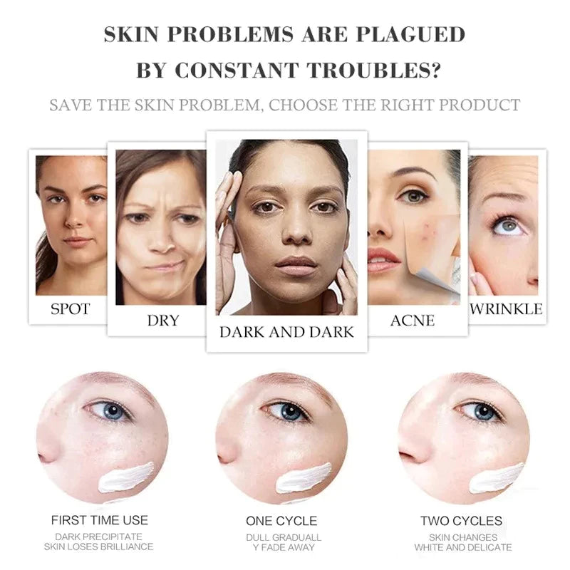 Houmai Skin Whitening and Freckle Removing Cream 20g