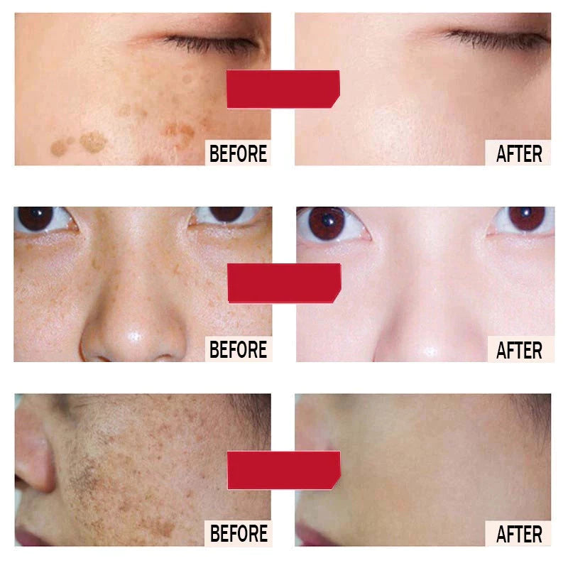 Houmai Skin Whitening and Freckle Removing Cream 20g