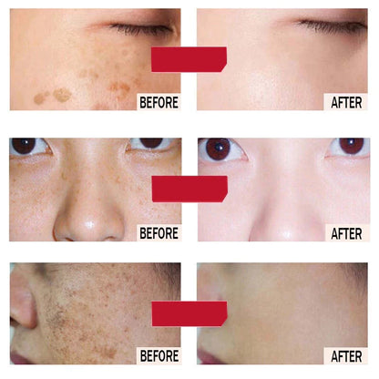 Houmai Skin Whitening and Freckle Removing Cream 20g