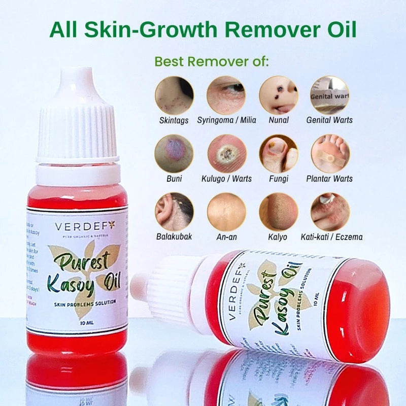 Verdef Purest Kasoy Oil Skin Problems Solution Warts Remover 10ml