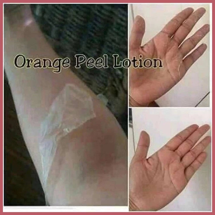 ORIGINAL 100% ORANGE PEELING LOTION